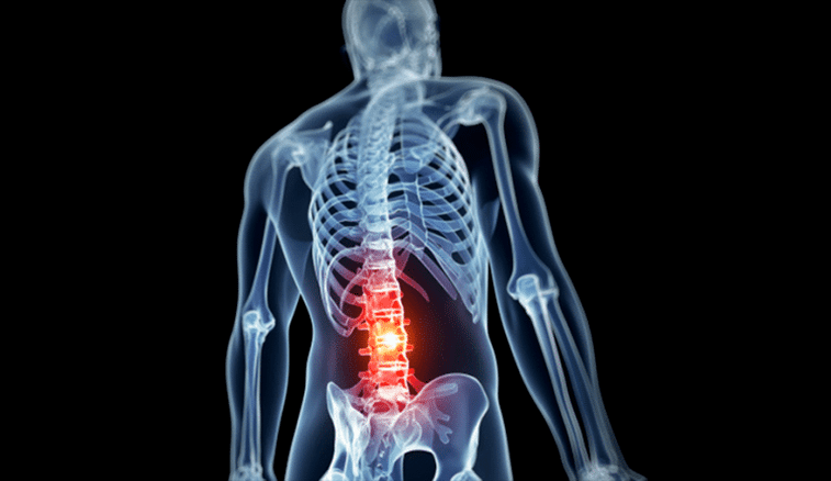 sugat ng lumbar spine sa osteochondrosis