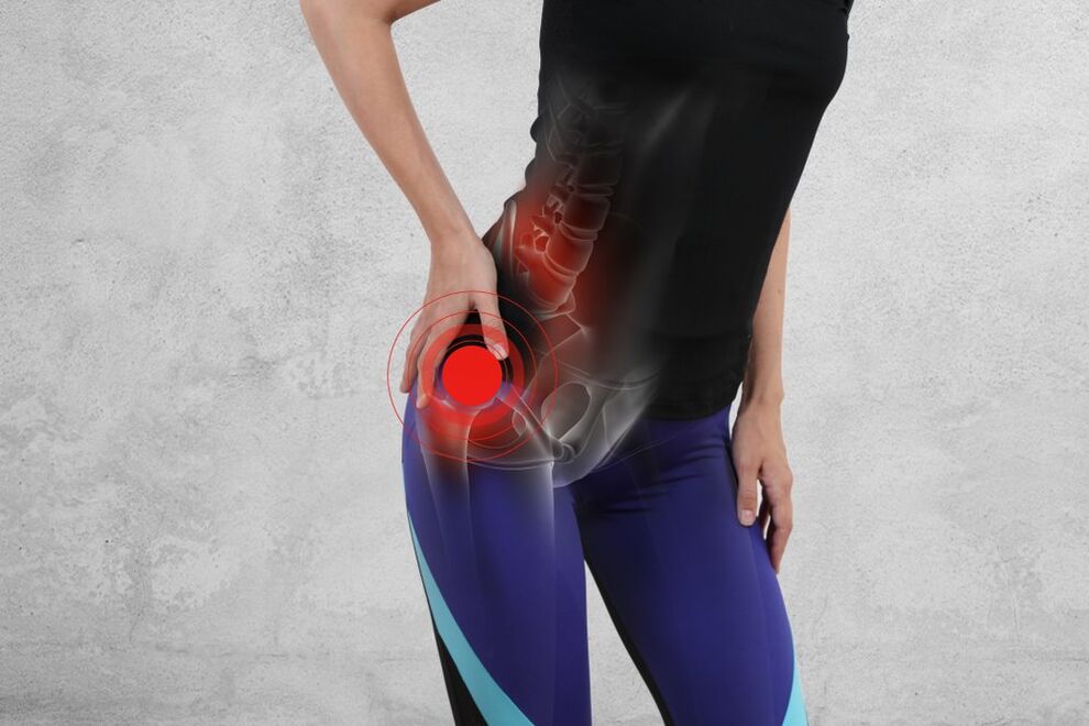 arthrosis ng hip joint