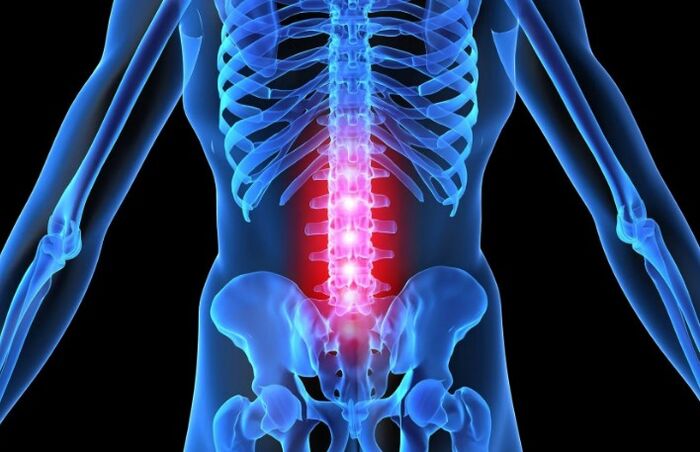Osteochondrosis ng rehiyon ng lumbar