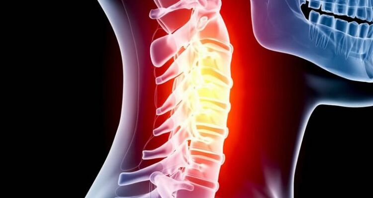 Pamamaga ng rehiyon ng cervical