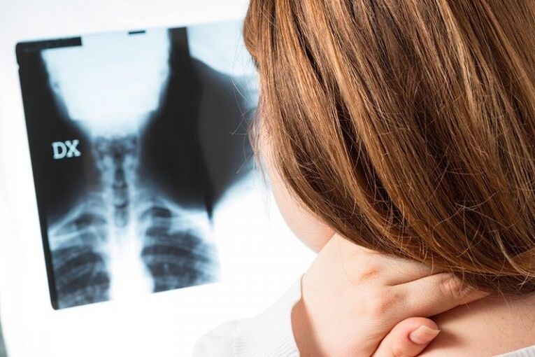 X -ray ng rehiyon ng cervical
