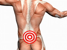 Mga sintomas at paggamot ng lumbar osteochondrosis