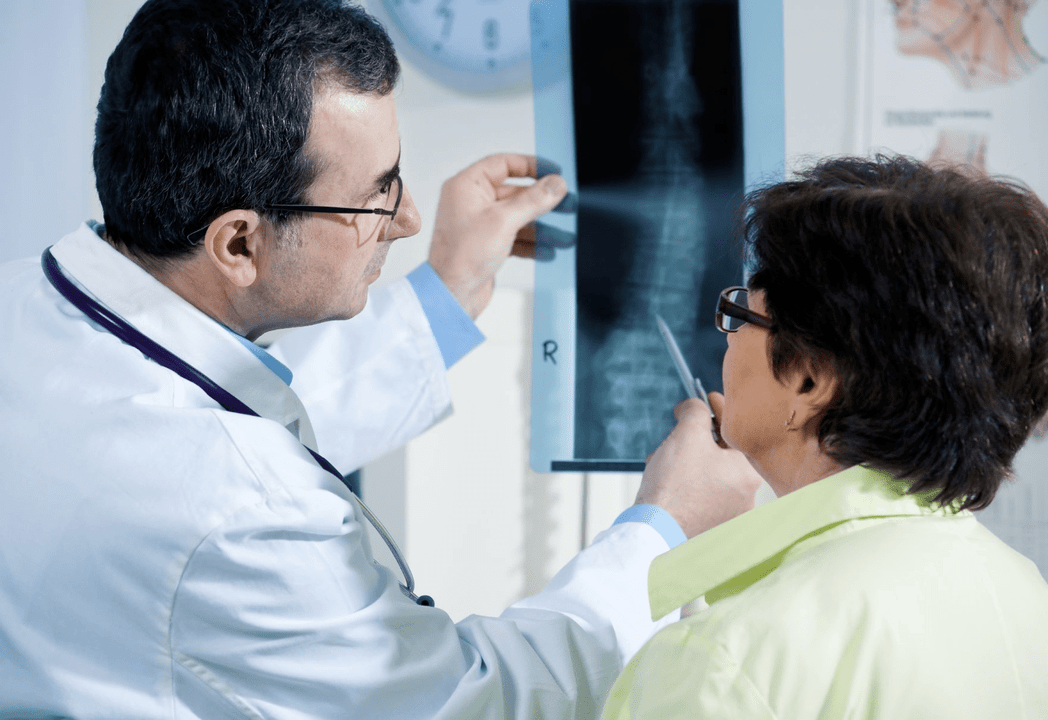 Ang isang neurologist ay nag-diagnose ng osteochondrosis gamit ang radiography ng gulugod