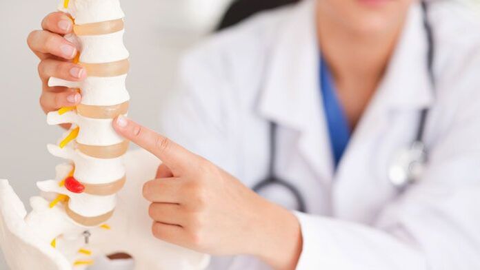 paliwanag ng lumbar osteochondrosis sa isang modelo ng gulugod